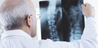 The Spine and Rehab Group Doctor looking at X-Ray