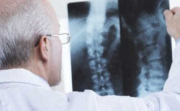 The Spine and Rehab Group Doctor looking at X-Ray